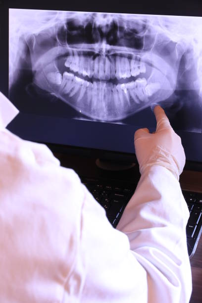 Best Emergency Gum Treatment in Burlington, KS