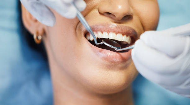 Best Emergency Treatment for Dental Infections or Abscesses in Burlington, KS